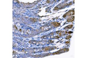 IHC analysis of Tspan-8/Tspan8 using anti-Tspan-8/Tspan8 antibody (ABIN7599681). (Tspan-8 Antikörper  (AA 108-203))