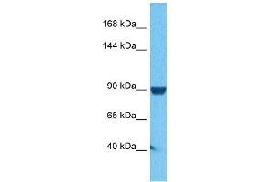 Host:  Rabbit  Target Name:  Atp6v0a1  Sample Tissue:  Human DLD1 Whole Cell  Antibody Dilution:  1ug/ml (ATP6V0A1 Antikörper  (C-Term))