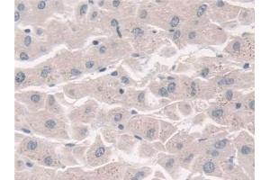 Immunohistochemistry (IHC) image for anti-Fucosyltransferase 6 (Alpha (1,3) Fucosyltransferase) (FUT6) (AA 35-359) antibody (ABIN7435952)