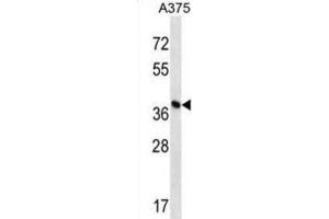 Western Blotting (WB) image for anti-DPH1 Homolog (DPH1) antibody (ABIN2998833) (DPH1 Antikörper)