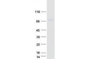 Western Blotting (WB) image for Ectonucleoside Triphosphate diphosphohydrolase 4 (ENTPD4) (Transcript Variant 1) protein (Myc-DYKDDDDK Tag) (ABIN2720203)