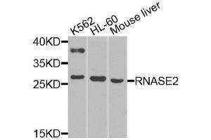 Western blot analysis of extracts of various cell lines, using RNASE2 antibody (ABIN6003657) at 1/1000 dilution. (RNASE2 Antikörper)