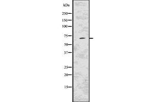 Western blot analysis of KCND2 using MCF7 whole  lysates. (KCND2 Antikörper  (C-Term))