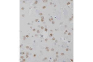 D staining MeCP2 in mouse brain tissue sections by Immunohistochemistry (IHC-P - paraformaldehyde-fixed, paraffin-embedded sections). (MECP2 Antikörper  (AA 400-428))