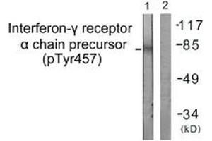 Western blot analysis of extracts from COS7 cells, using Interferon-gamma Receptor alpha (Phospho-Tyr457) Antibody. (IFNGR1 Antikörper  (pTyr457))