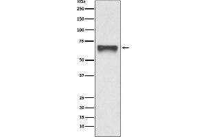 Western blot analysis of FoxO4 expression in 293T cell lysate transfected with FoxO4.