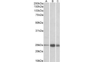 ABIN1590144 (1 µg/mL) staining of Human (A), Mouse(B) and Rat (C) Skeletal Muscle lysate (35 µg protein in RIPA buffer). (TNNI2 Antikörper  (AA 83-95))