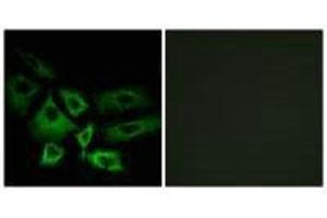 Immunofluorescence analysis of A549 cells, using NT5C1A antibody. (NT5C1A Antikörper)