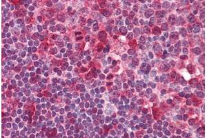 Human Tonsil (formalin-fixed, paraffin-embedded) stained with SYK antibody ABIN239825 at 5 ug/ml followed by biotinylated anti-mouse IgG secondary antibody ABIN481714, alkaline phosphatase-streptavidin and chromogen. (SYK Antikörper  (AA 5-360))