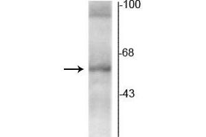 Western blot of rat hippocampal lysate showing specific immunolabeling of the ~58 kDa TR-α2 protein.