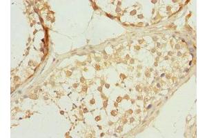 Immunohistochemistry of paraffin-embedded human testis tissue using ABIN7146273 at dilution of 1:100 (Calcineurin B Antikörper  (AA 1-170))
