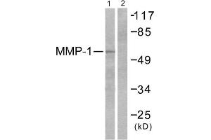 Western blot analysis of extracts from HepG2 cells, using MMP-1 antibody (ABIN5976455). (MMP1 Antikörper  (C-Term))