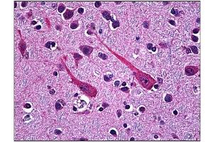 Immunohistochemistry (IHC) image for anti-Proprotein Convertase Subtilisin/kexin Type 1 (PCSK1) (AA 652-754) antibody (ABIN781869) (PCSK1 Antikörper  (AA 652-754))