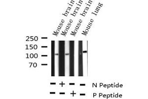 Western blot analysis of Phospho-B-RAF (Ser446) expression in various lysates (BRAF Antikörper  (pSer446))