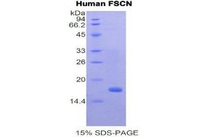 SDS-PAGE (SDS) image for Fascin (FSCN1) (AA 277-396) protein (His tag) (ABIN2121006) (Fascin Protein (FSCN1) (AA 277-396) (His tag))