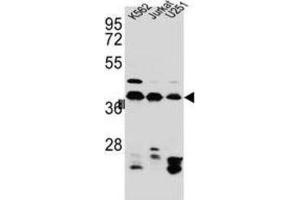 Western Blotting (WB) image for anti-Heterogeneous Nuclear Ribonucleoprotein C (C1/C2) (HNRNPC) antibody (ABIN2995806) (HNRNPC Antikörper)