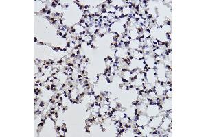 Immunohistochemistry of paraffin-embedded mouse lung using Acetyl-Histone H3-K27 Rabbit mAb (ABIN3016650, ABIN3016651, ABIN3016652, ABIN1682513 and ABIN1682514) at dilution of 1:100 (40x lens). (Histone 3 Antikörper  (acLys27))