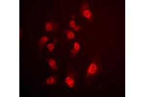 Immunofluorescent analysis of SMAD4 staining in HeLa cells. (SMAD4 Antikörper  (N-Term))
