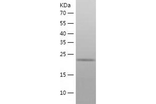 FGF23 Protein (AA 25-251) (His tag)