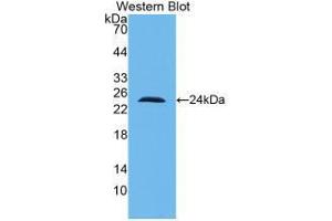 Western blot analysis of recombinant Human IL10. (IL-10 Antikörper  (AA 1-178))