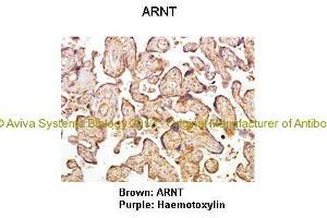 Researcher: Hiten D. (ARNT Antikörper  (C-Term))