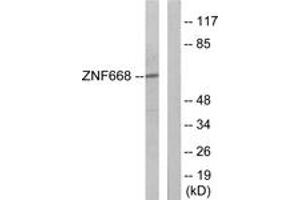 Western blot analysis of extracts from Jurkat cells, using ZNF668 Antibody. (ZNF668 Antikörper  (AA 271-320))