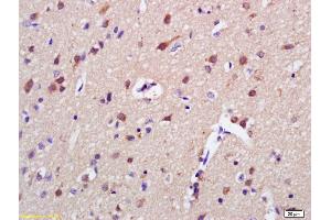 Formalin-fixed and paraffin embedded rat brain labeled with Anti-AKAP7 Polyclonal Antibody, Unconjugated (ABIN1387303) at 1:200 followed by conjugation to the secondary antibody and DAB staining (AKAP7 Antikörper  (AA 31-80))