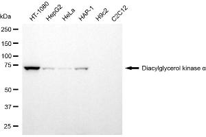 Western blotting analysis using diacylglycerol kinase alpha antibody (ABIN7798326). (DGKA Antikörper)