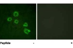 Immunofluorescence analysis of HUVEC cells, using PLA2G4A polyclonal antibody . (PLA2G4A Antikörper)