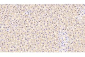 Detection of TFR in Rat Liver Tissue using Polyclonal Antibody to Transferrin Receptor (TFR) (Transferrin Receptor Antikörper  (AA 587-756))