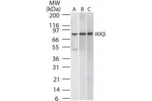 Image no. 1 for anti-Inhibitor of kappa Light Polypeptide Gene Enhancer in B-Cells, Kinase beta (IKBKB) antibody (ABIN208069) (IKBKB Antikörper)