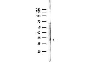 anti-Stem-Loop Binding Protein (SLBP) antibody