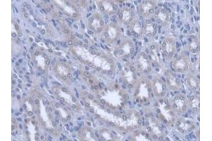 DAB staining on IHC-P; Samples: Rat Kidney Tissue (PLTP Antikörper  (AA 337-479))