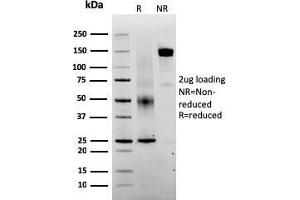 SDS-PAGE (SDS) image for anti-SERPINE1 mRNA Binding Protein 1 (SERBP1) (AA 3-139) antibody (ABIN6939487)