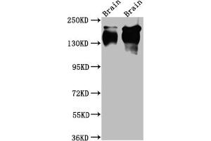 Western Blot Positive WB detected in: Rat Brain whole cell lysate, Mouse Brain whole cell lysate All lanes: TrkA Antibody at 1:1000 Secondary Goat polyclonal to rabbit IgG at 1/50000 dilution Predicted band size: 88, 87, 84, 78 kDa Observed band size: 145 kDa