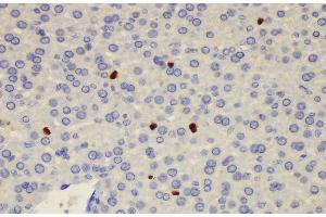 Immunohistochemistry of paraffin-embedded Rat liver using S100a8 Polycloanl Antibody at dilution of 1:200 (S100A8 Antikörper)