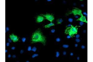 Anti-KATNB1 mouse monoclonal antibody (ABIN2455151) immunofluorescent staining of COS7 cells transiently transfected by pCMV6-ENTRY KATNB1 (RC201852). (KATNB1 Antikörper)