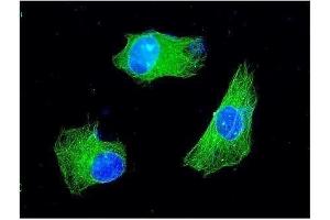 IF analysis of KChIP2 using anti-KChIP2 antibody (ABIN3043273).