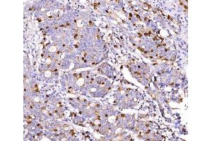IHC analysis of Geminin/GMNN using anti-Geminin/GMNN antibody (ABIN7600598). (Geminin Antikörper  (AA 21-196))