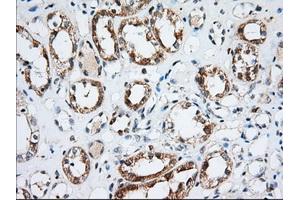 Immunohistochemical staining of paraffin-embedded Human Kidney tissue using anti-IGF2BP2 mouse monoclonal antibody. (IGF2BP2 Antikörper)