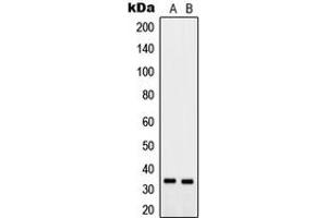 Western blot analysis of PTGR2 expression in MCF7 (A), PC12 (B) whole cell lysates. (PTGR2 Antikörper  (Center))