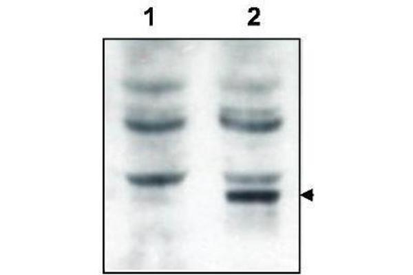 Tamalin/GRASP Antikörper  (N-Term)