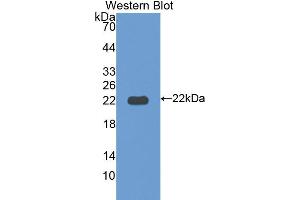 Western blot analysis of the recombinant protein. (ITLN1/Omentin Antikörper  (AA 101-292))