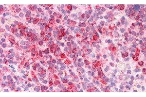 Detection of AZU in Human Spleen Tissue using Polyclonal Antibody to Azurocidin (AZU)