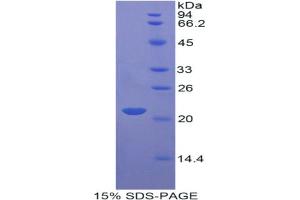 SDS-PAGE analysis of Rat Apolipoprotein D Protein.