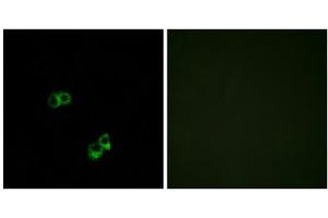 Immunofluorescence analysis of MCF-7 cells, using MC5R antibody. (MC5 Receptor Antikörper  (C-Term))