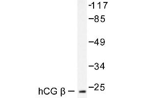 Image no. 1 for anti-Chorionic Gonadotropin (hCG) antibody (ABIN265452) (hCG Antikörper)