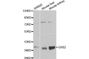 Western blot analysis of extracts of various cell lines, using GAS2 antibody (ABIN5970514) at 1/1000 dilution. (GAS2 Antikörper)