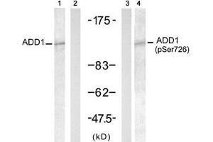 Western blot analysis of extract from HT-29 cells untreated or treated with Doxorubicin (1mM, 30min), using ADD1 (Ab-726) antibody (E021189, Lane 1 and 2) and ADD1 (Phospho- Ser726) antibody (E011182, Lane 3 and 4). (alpha Adducin Antikörper  (pSer726))