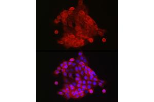 Immunofluorescence analysis of  cells using S100 Rabbit pAb (842) at dilution of 1:150 (40x lens). (S100A9 Antikörper  (AA 1-114))